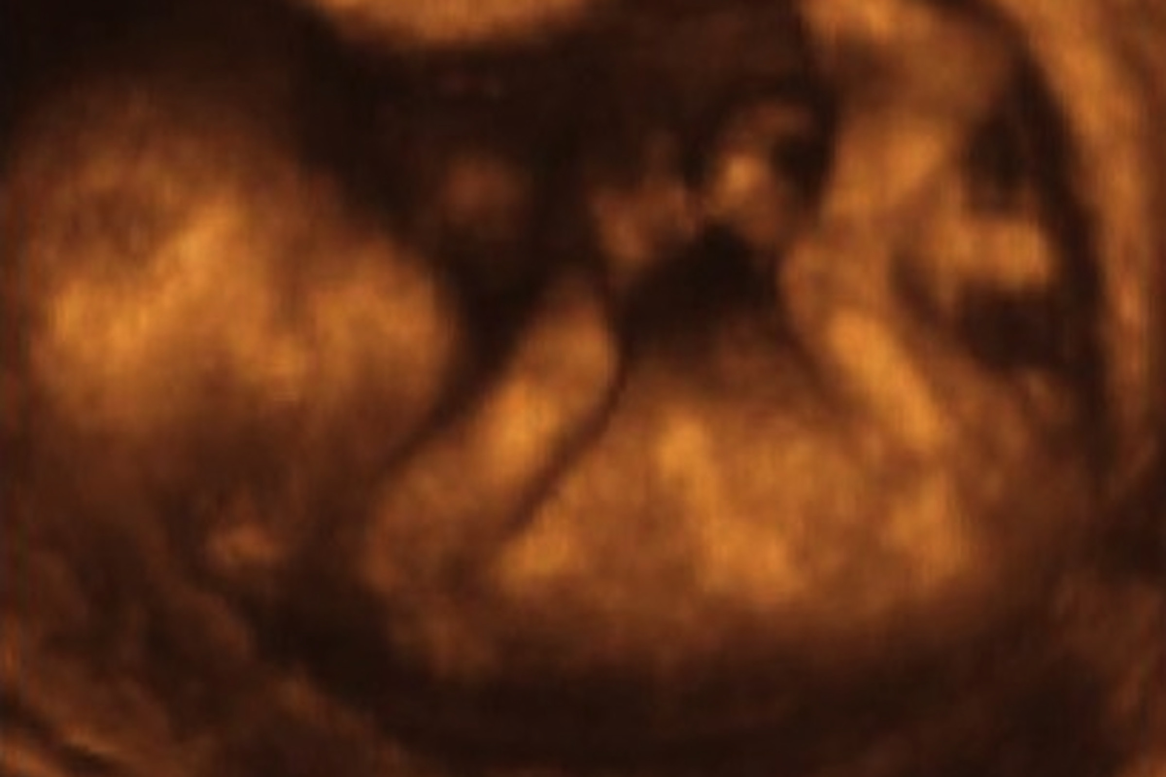 Fetus 4D