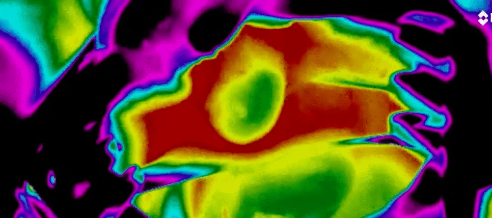 Thermal imaging of a beating heart.