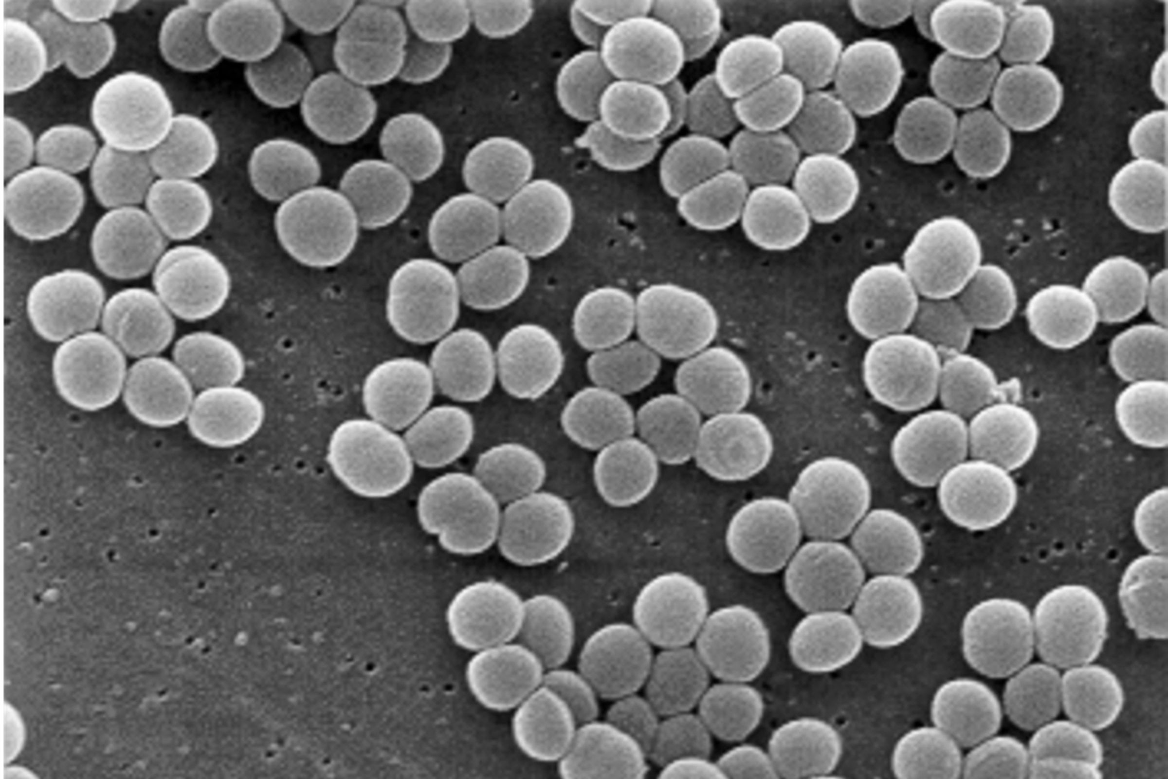 Staphylococcus superbug (wikimedia)