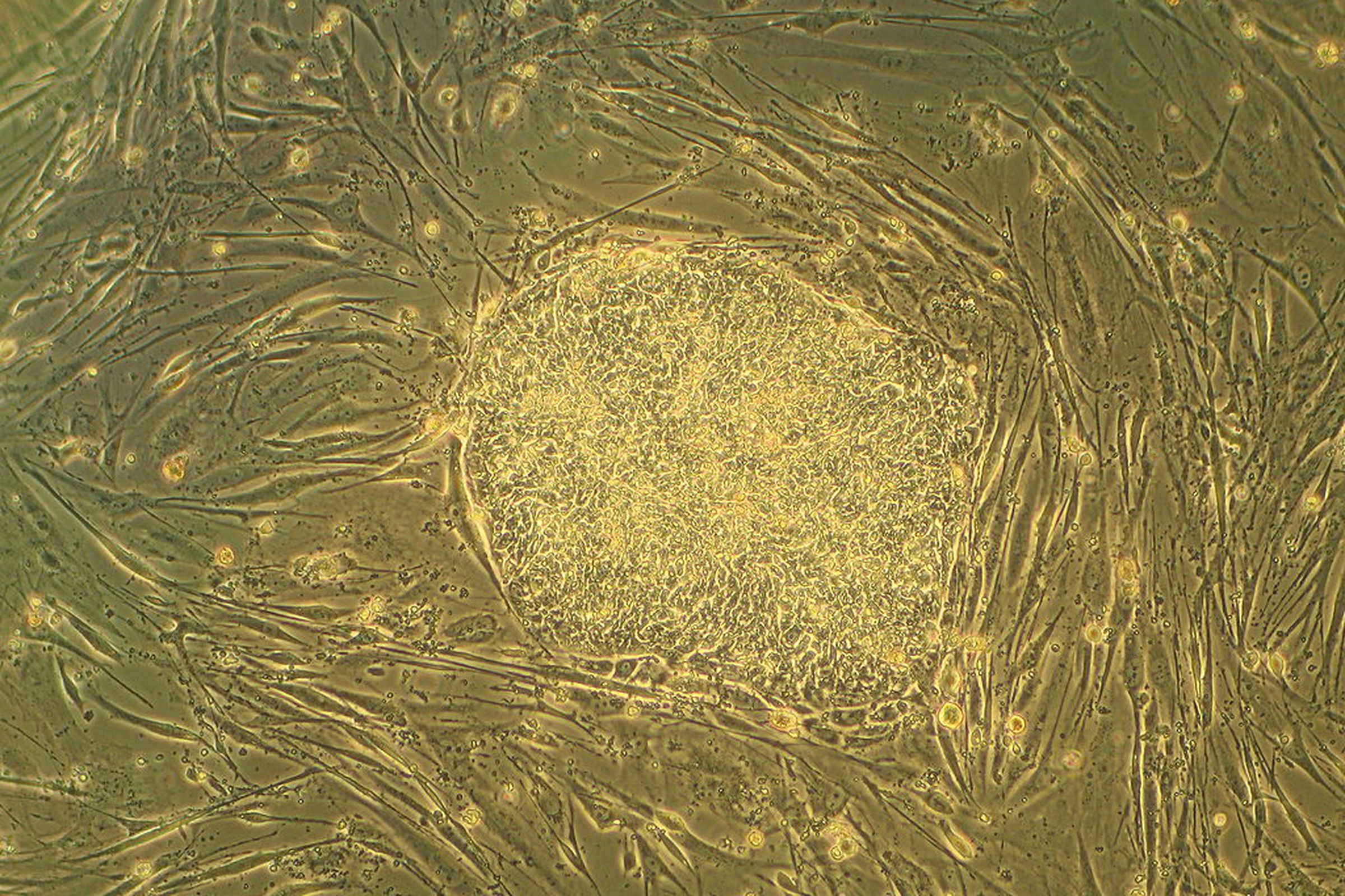 human stem cell - Ryddragyn (wikimedia commons)