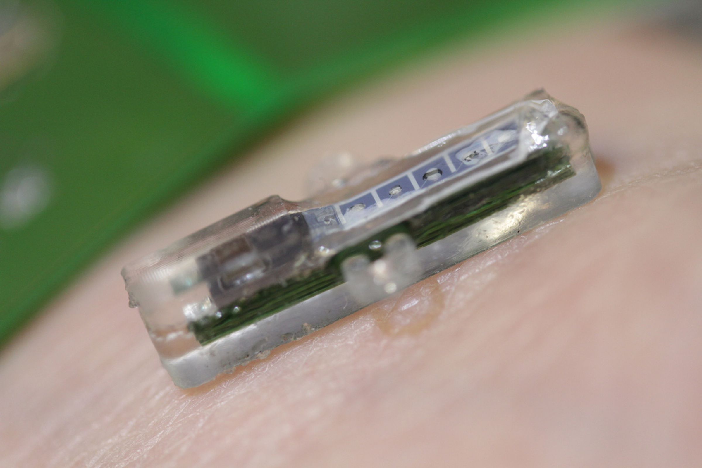 Blood test implant bluetooth sensor