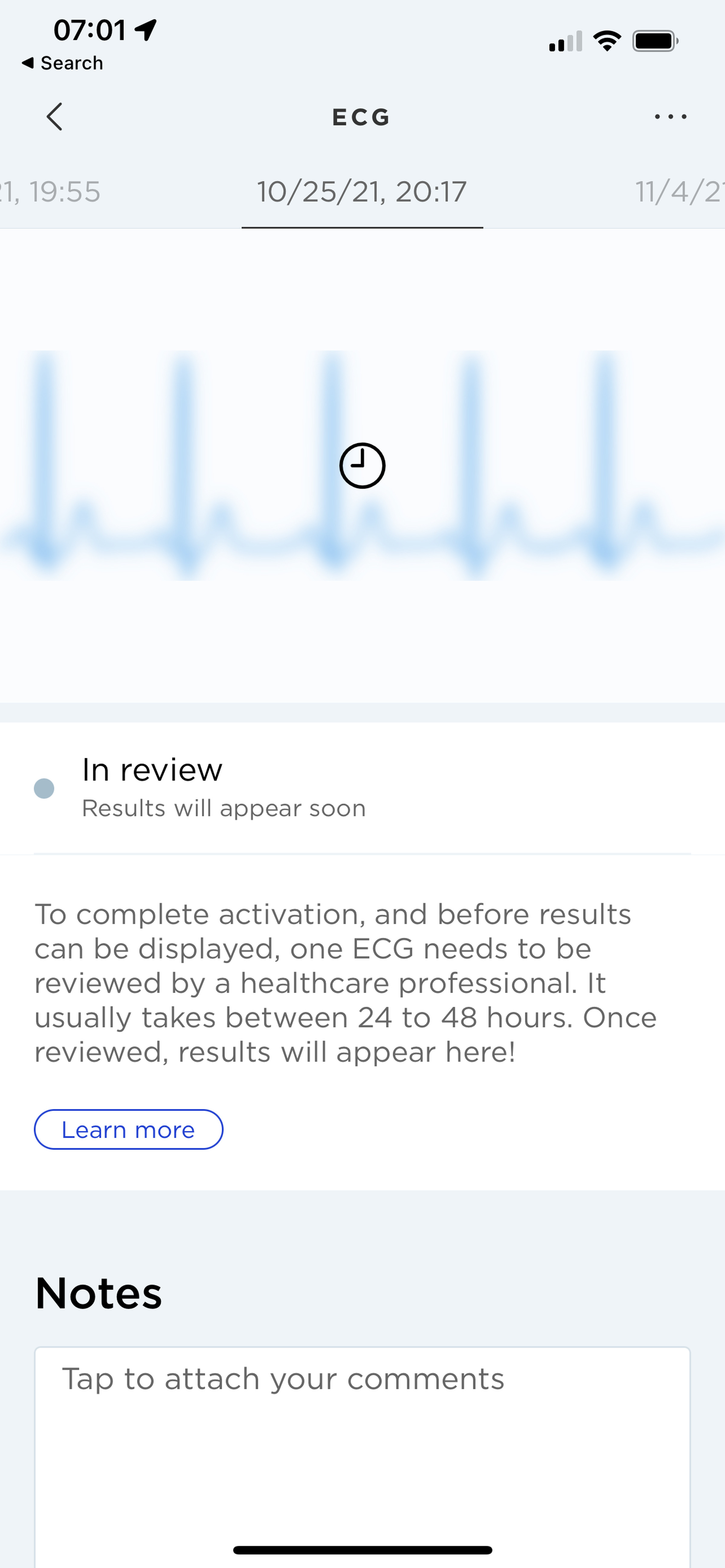 The ScanWatch requires a healthcare provider review before the EKG feature is turned on.