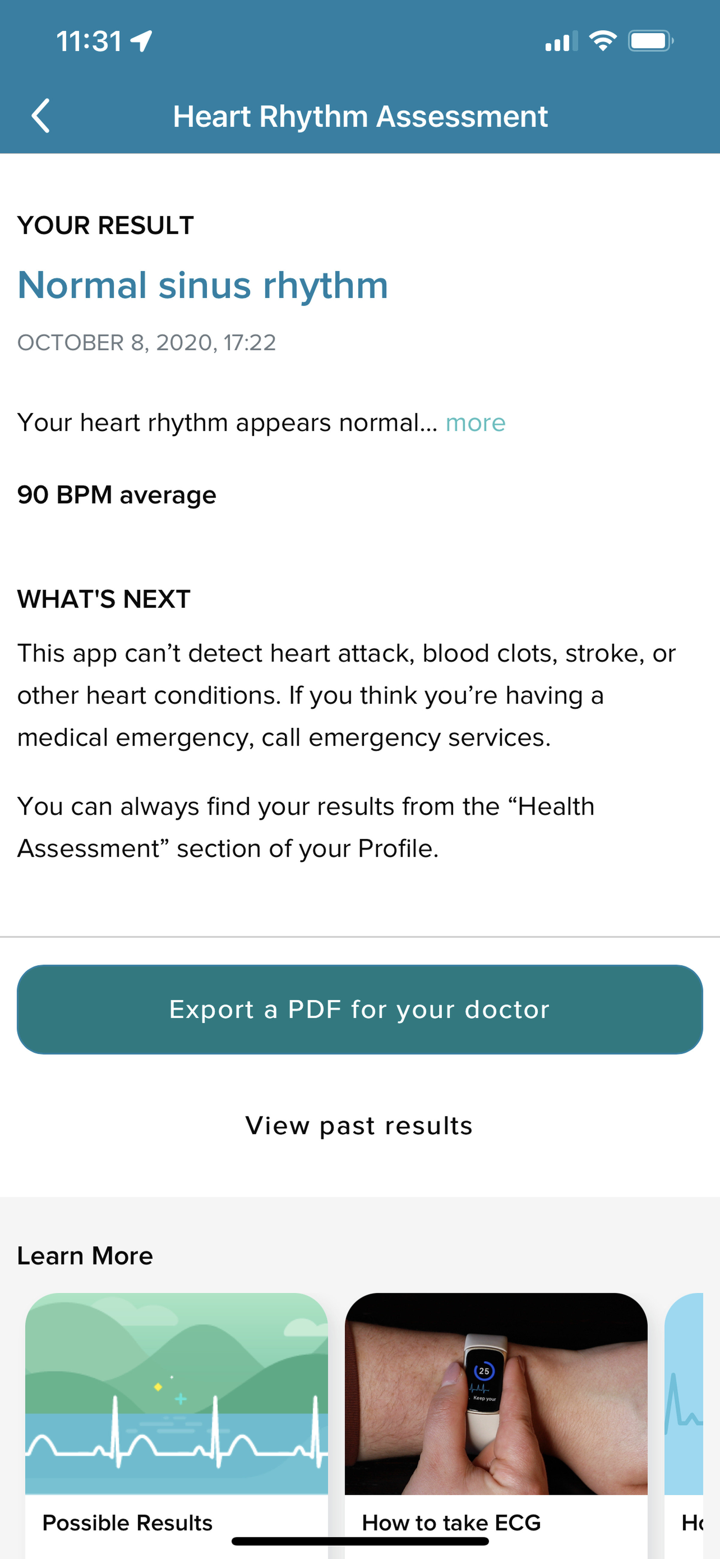 You can export your EKG results to a PDF and send it to your doctor