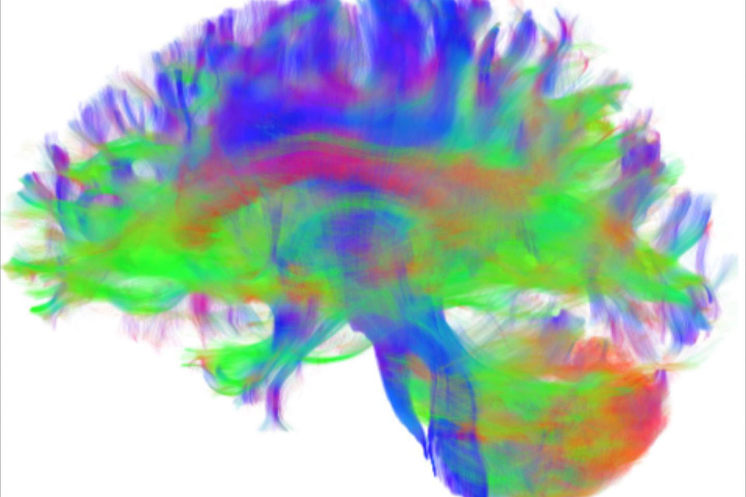 This image is a rendering of diffusion tractography, which was used to reconstruct the anatomical pathways in each participant's brain.