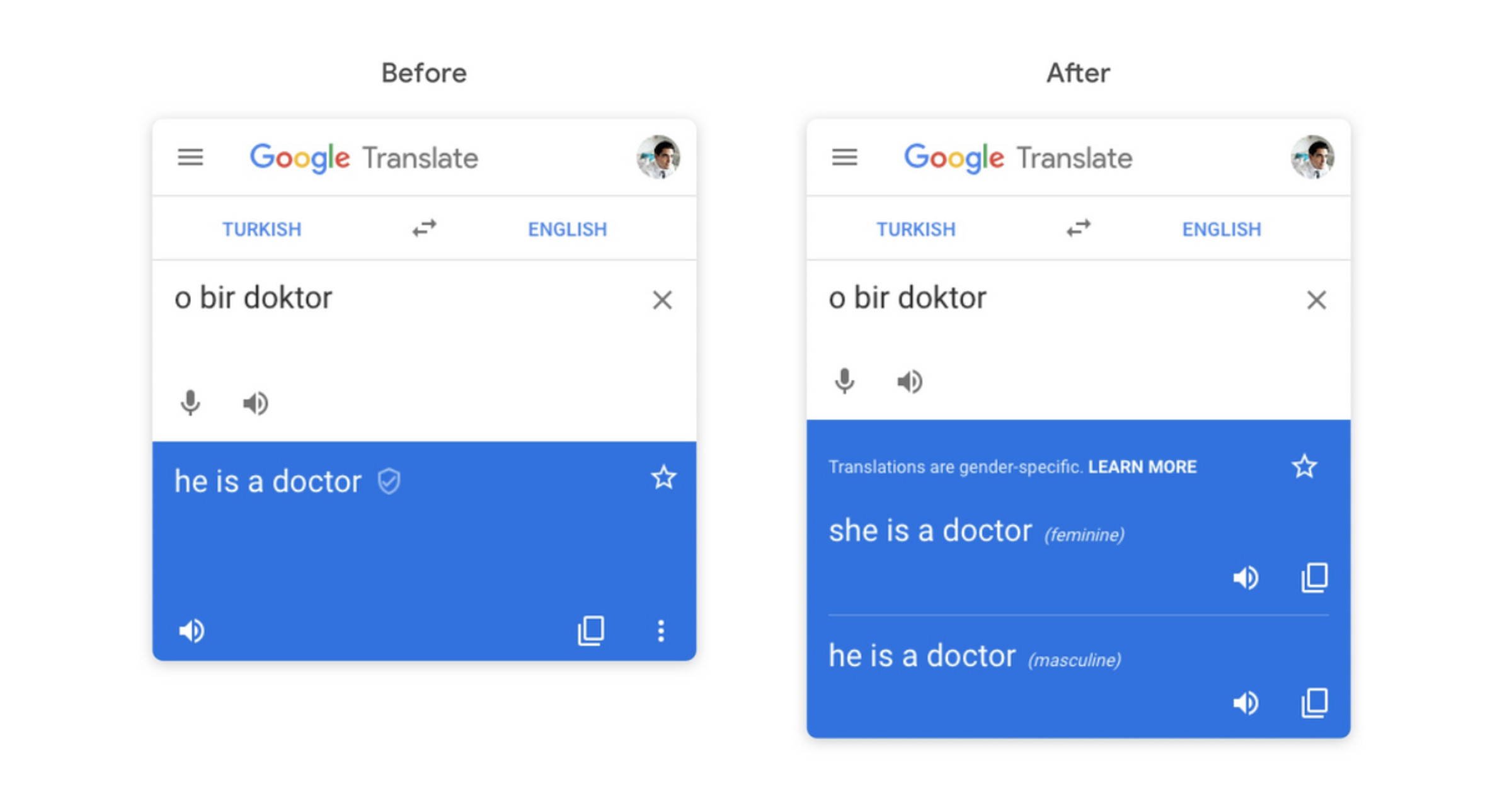 An example of gendered translations options in Google Translate.