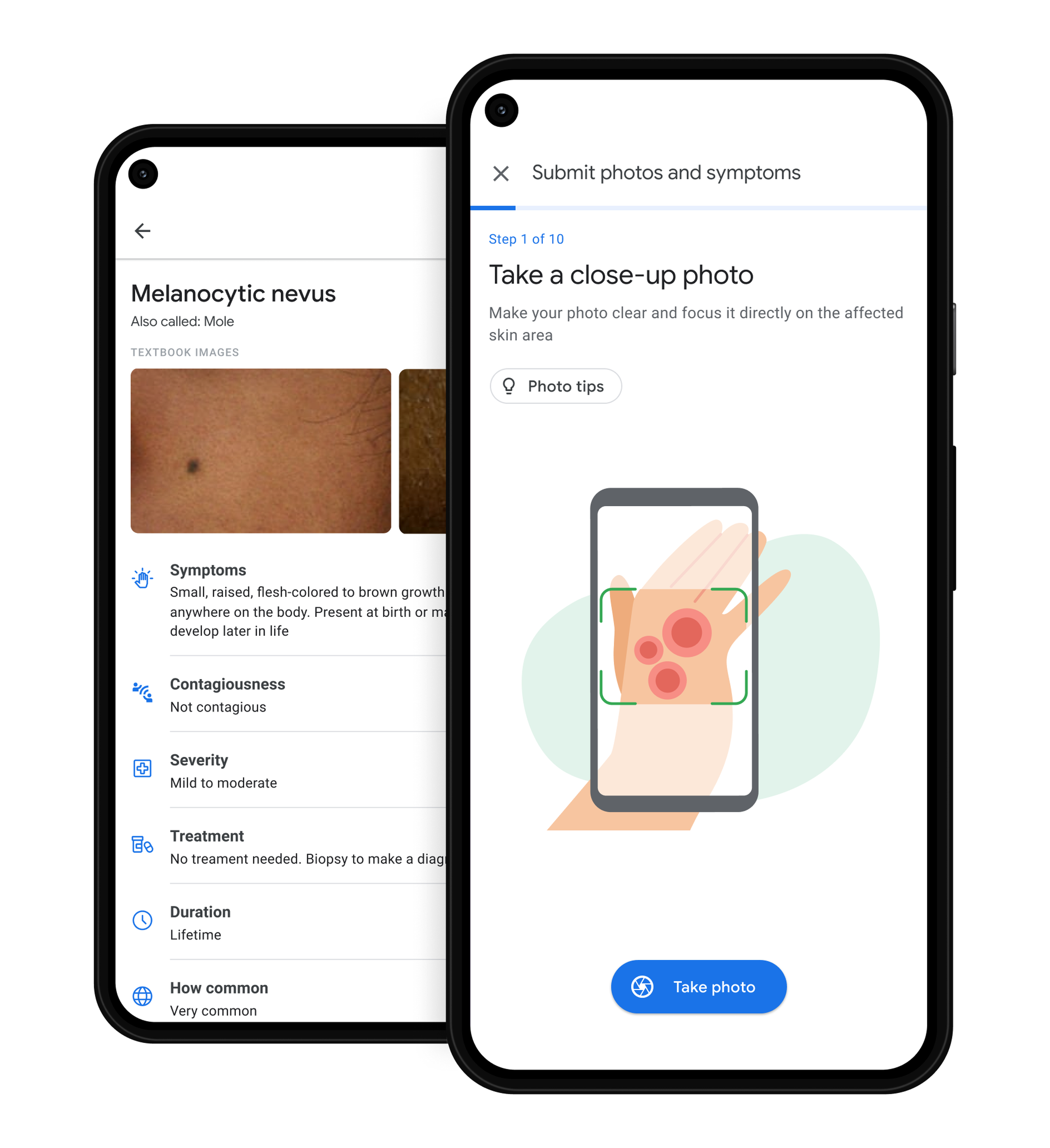 The Google tool asks people to take three photos of a skin problem, and then it offers possible conditions.