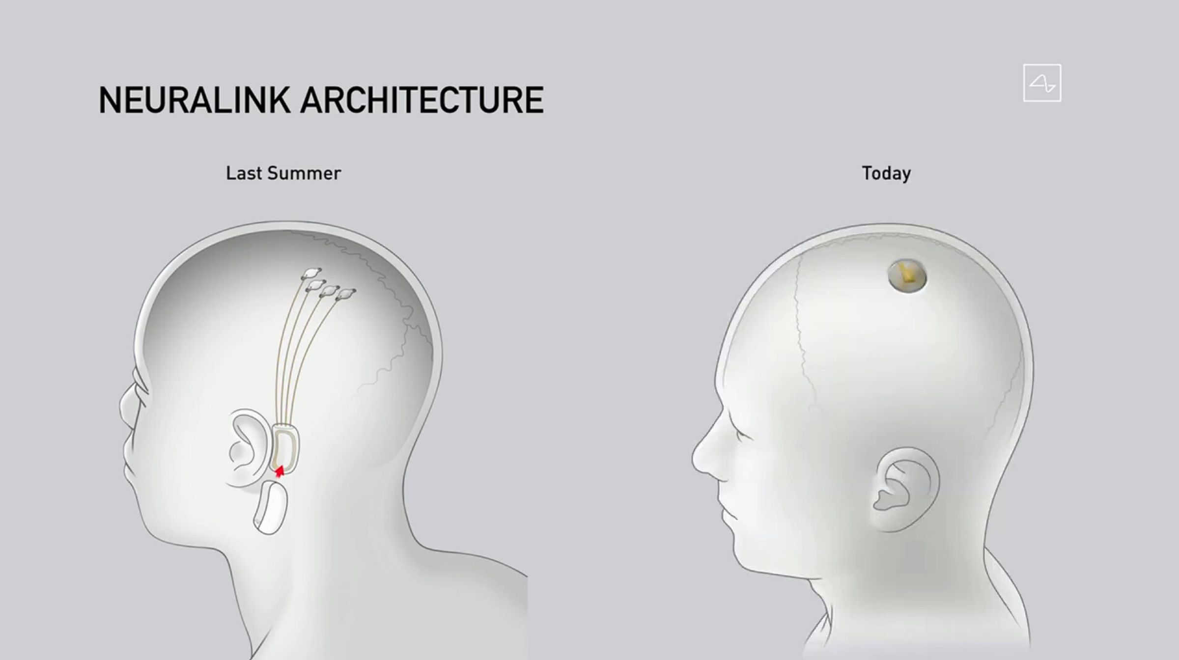 Screenshot from the Neuralink presentation 