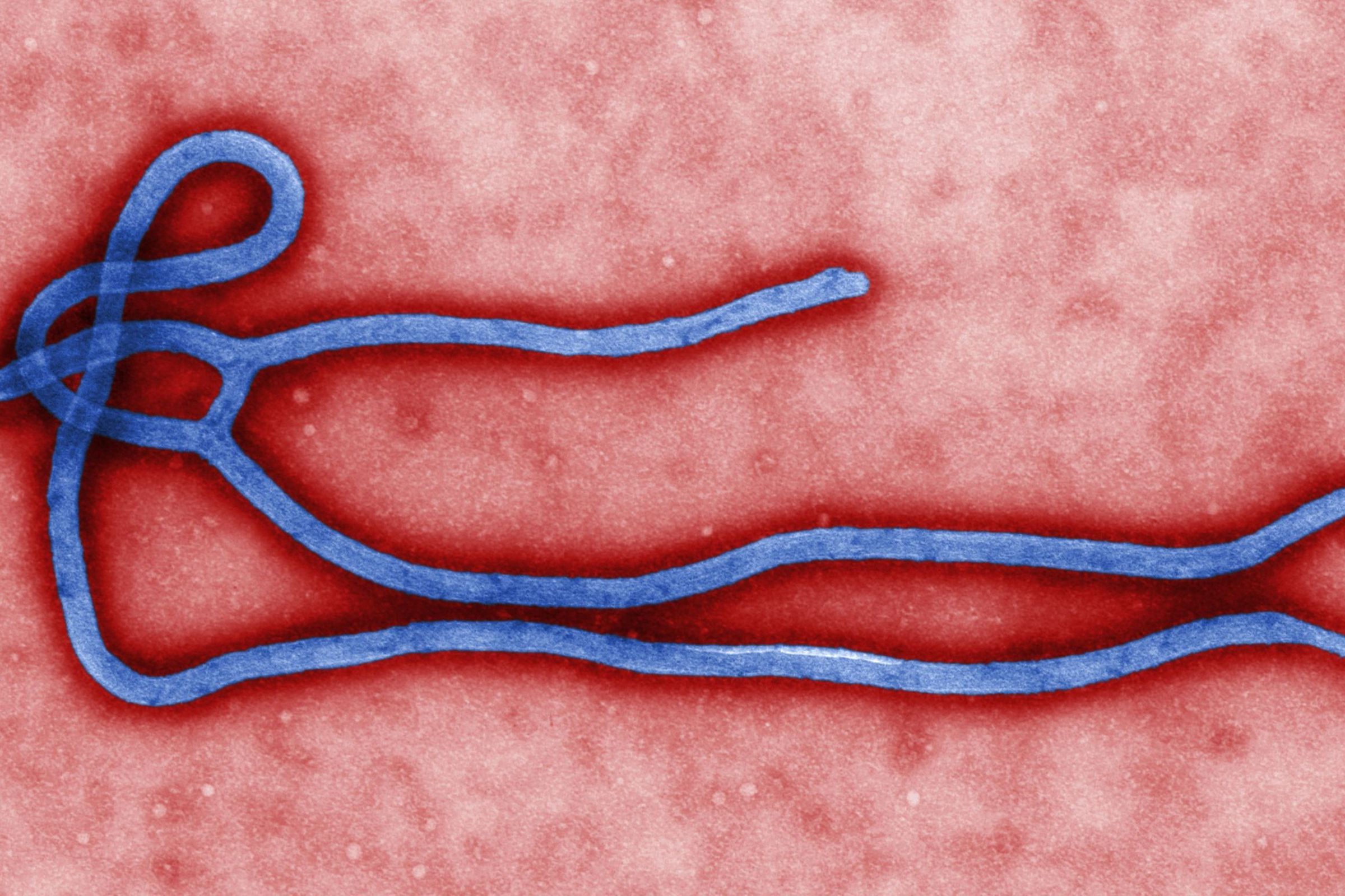 ebola-virus-wikimedia-commons