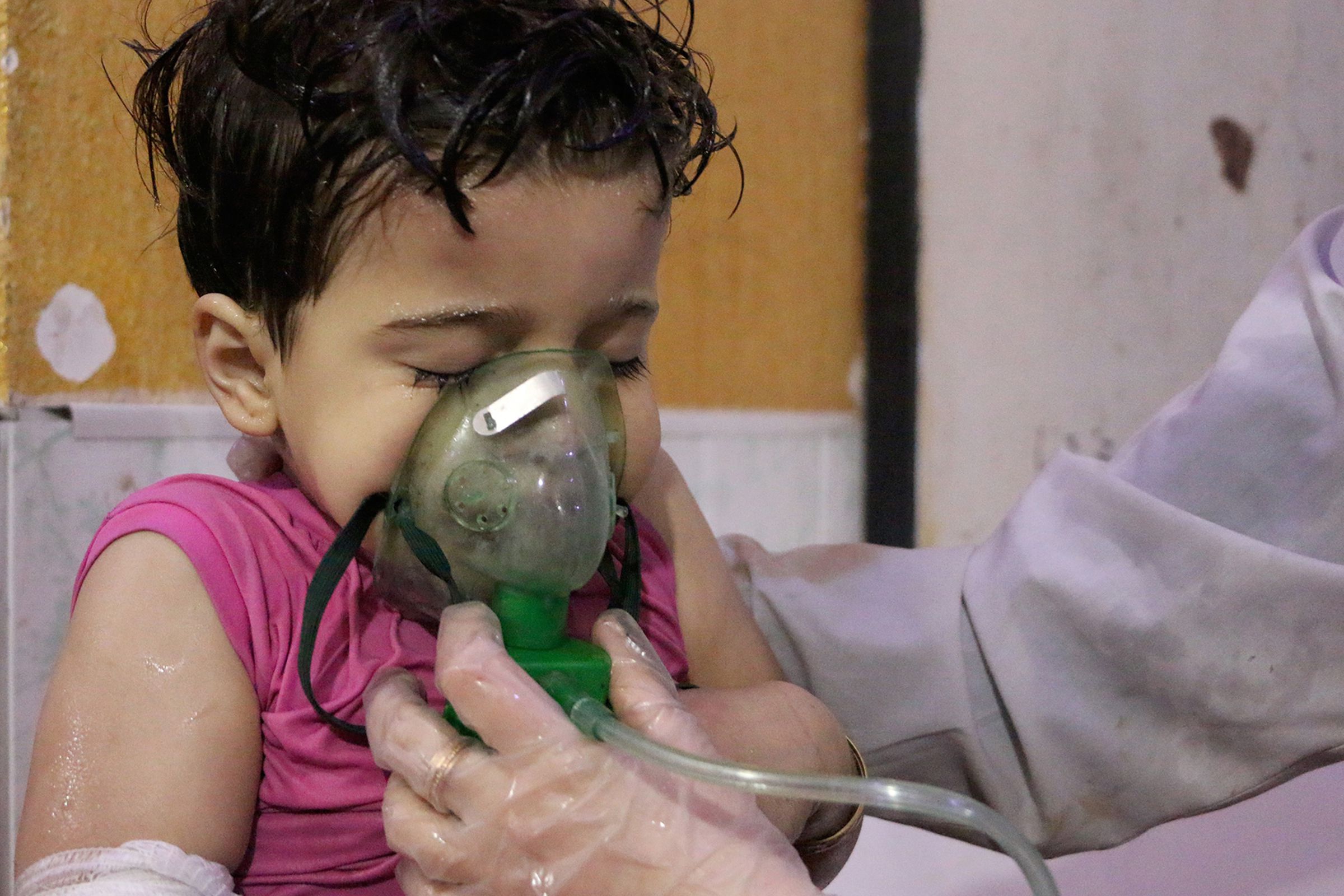 A survivor of the suspected chemical attack on Douma, Syria. 