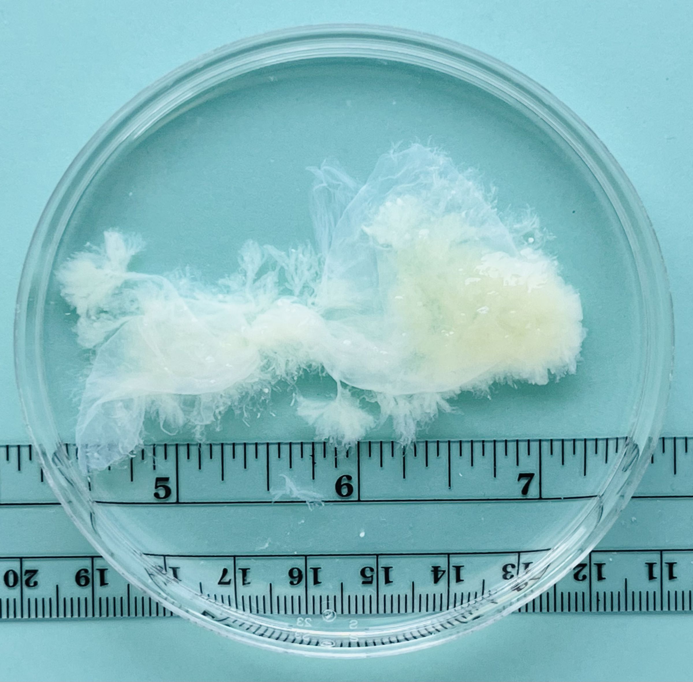 A cloud of white tissue lies in a petri dish on a blue background. 