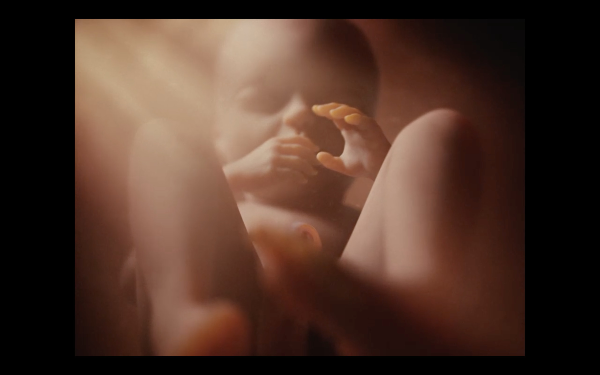 A CI fetus in a fetal position depicted in an unnaturally well-lit CG womb.
