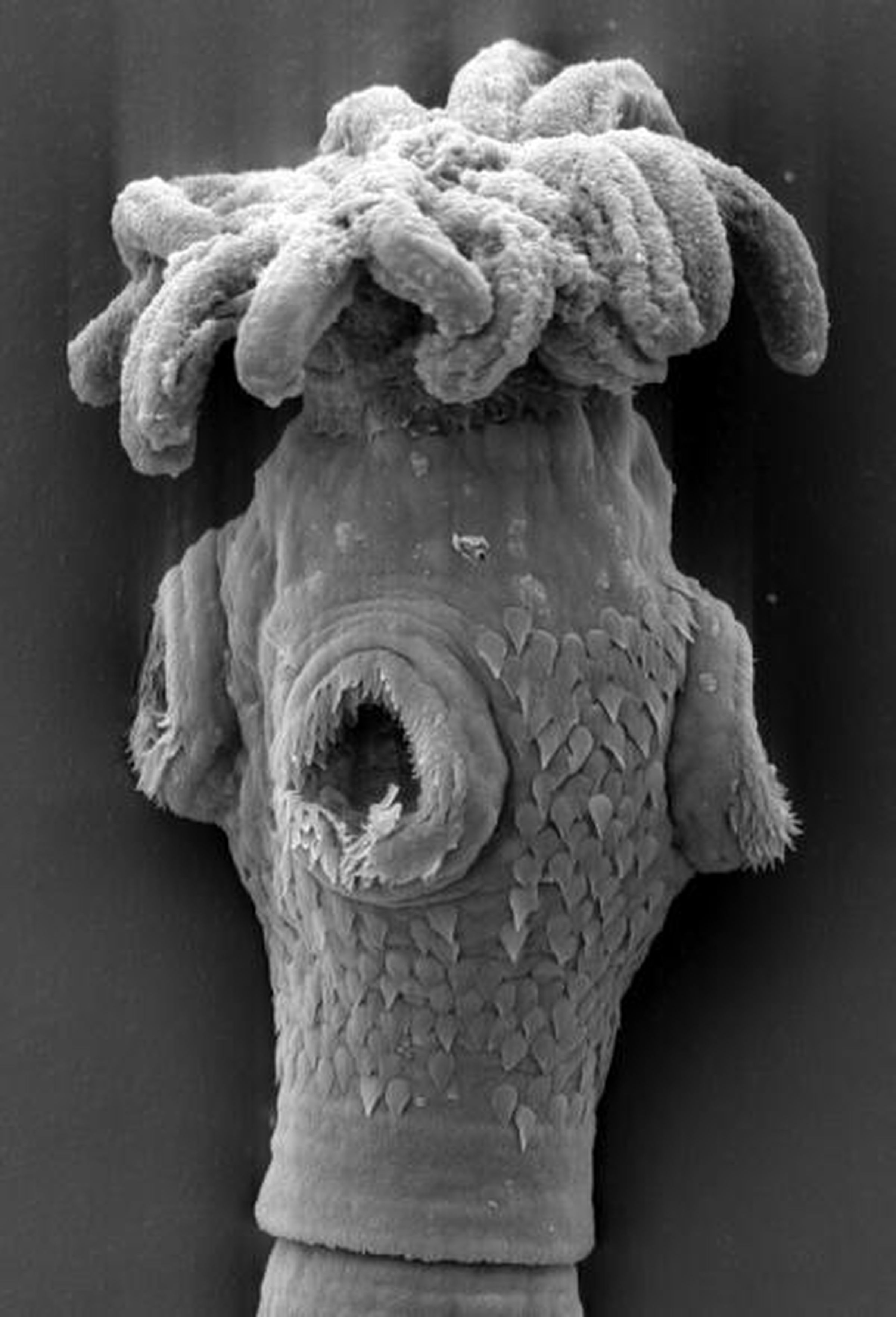 This is the part of a tapeworm that latches onto its host’s intestine. This particular tapeworm was discovered in a Giant Shovelnose Ray from Australia.