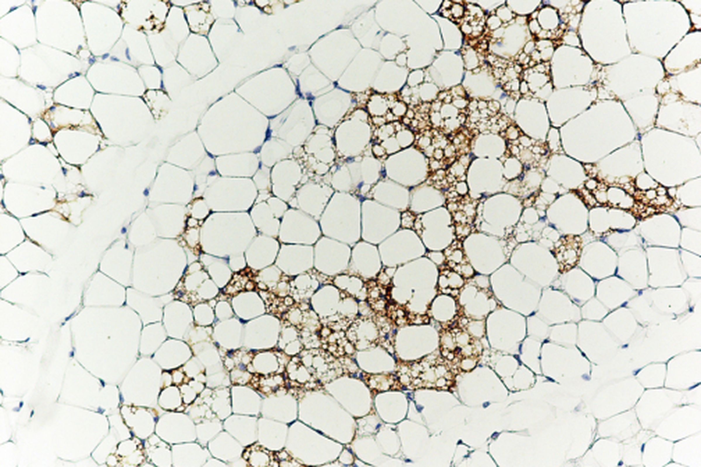  Brown fat cells (stained brown with antibodies against the brown fat-specific protein Ucp1) nestled in amongst white fat cells.