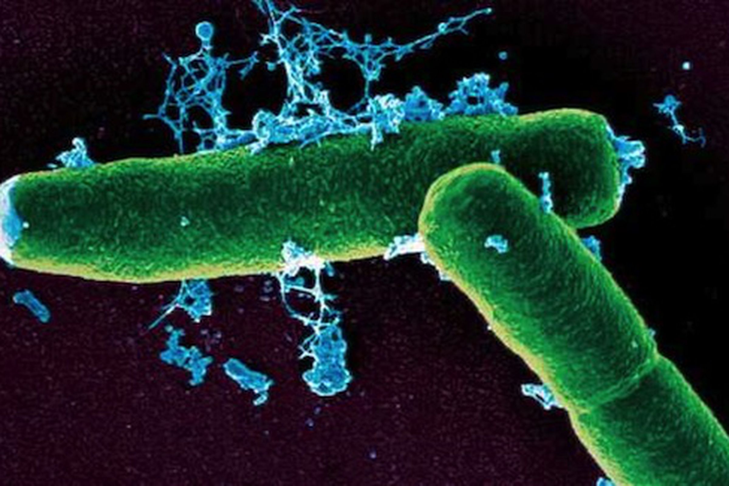 Anthrax bacteria microscope view--Kenyon College MicrobeWiki