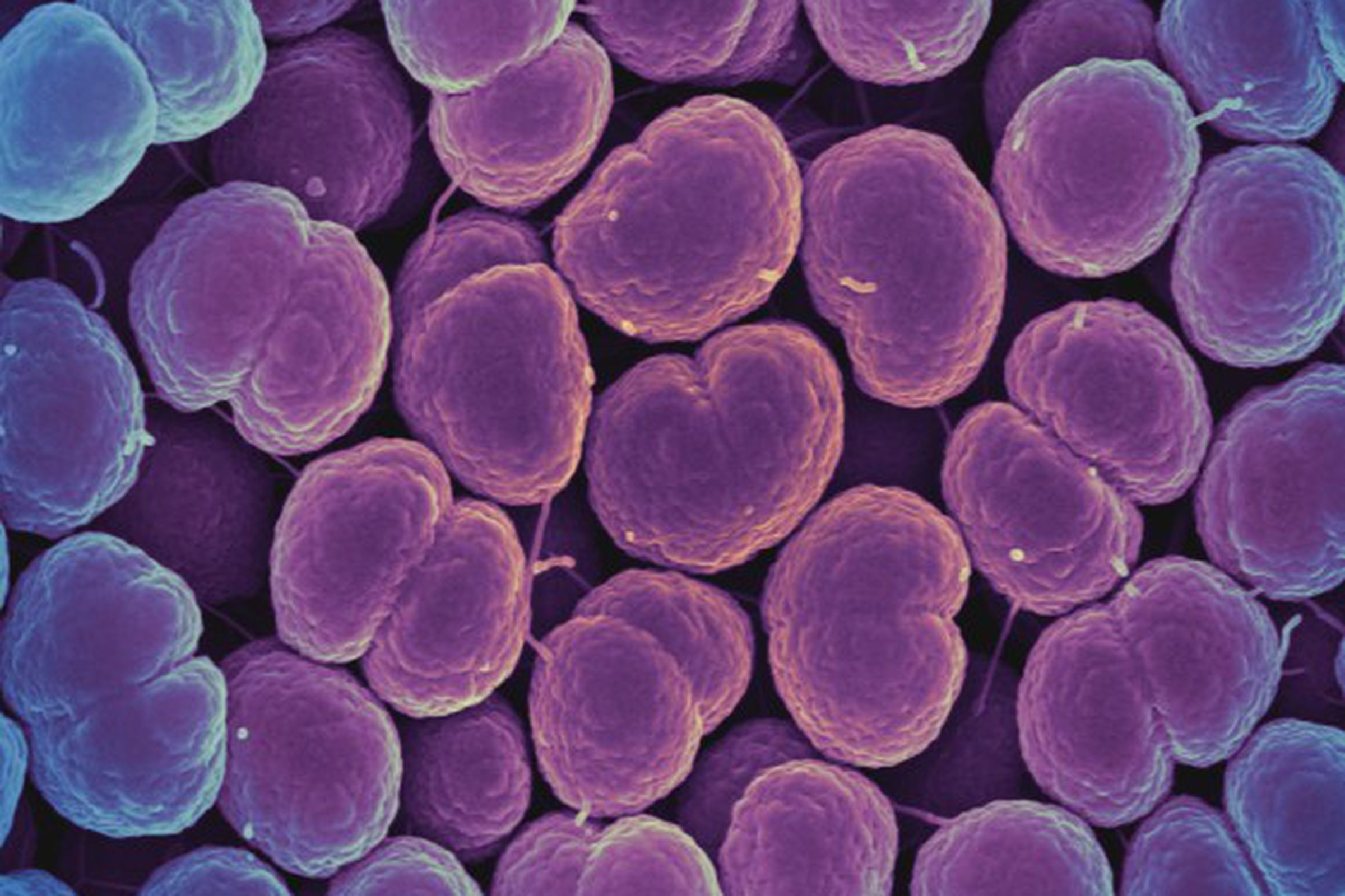 The Neisseria gonorrhoeae bacteria, which cause gonorrhea.