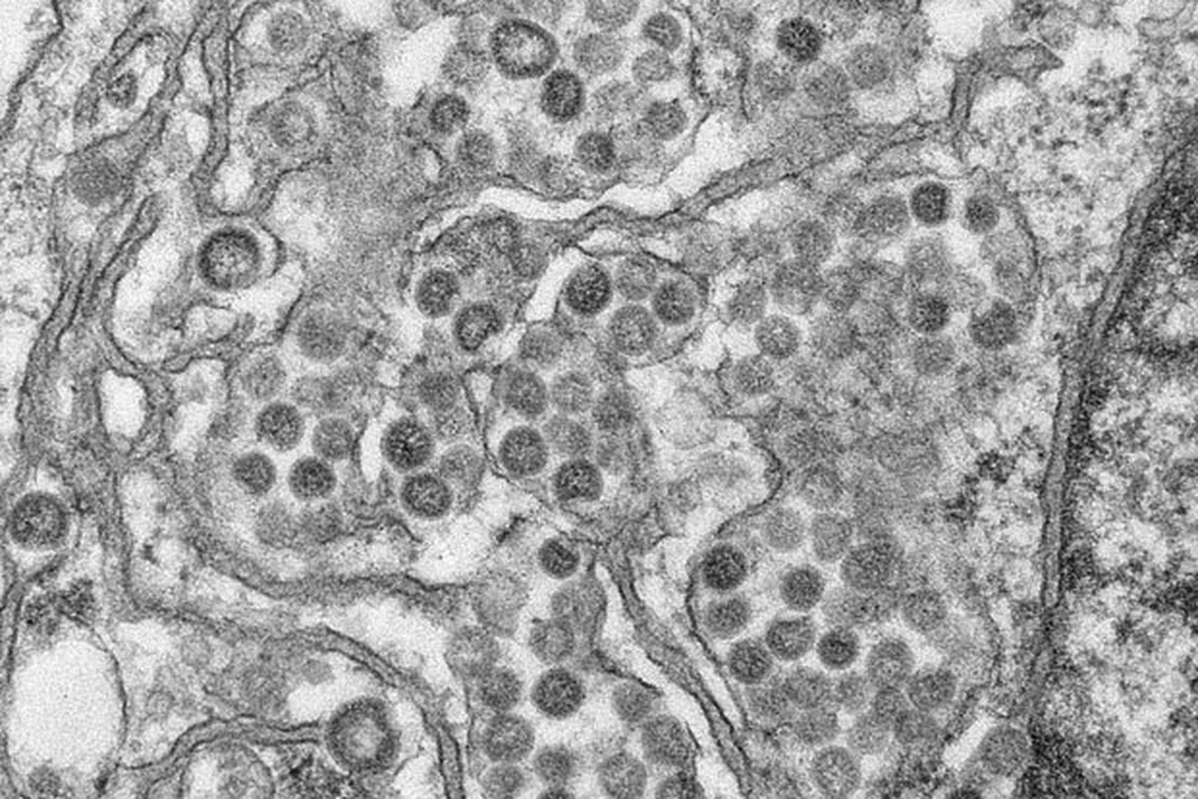 MERS virus (Credit: CDC)