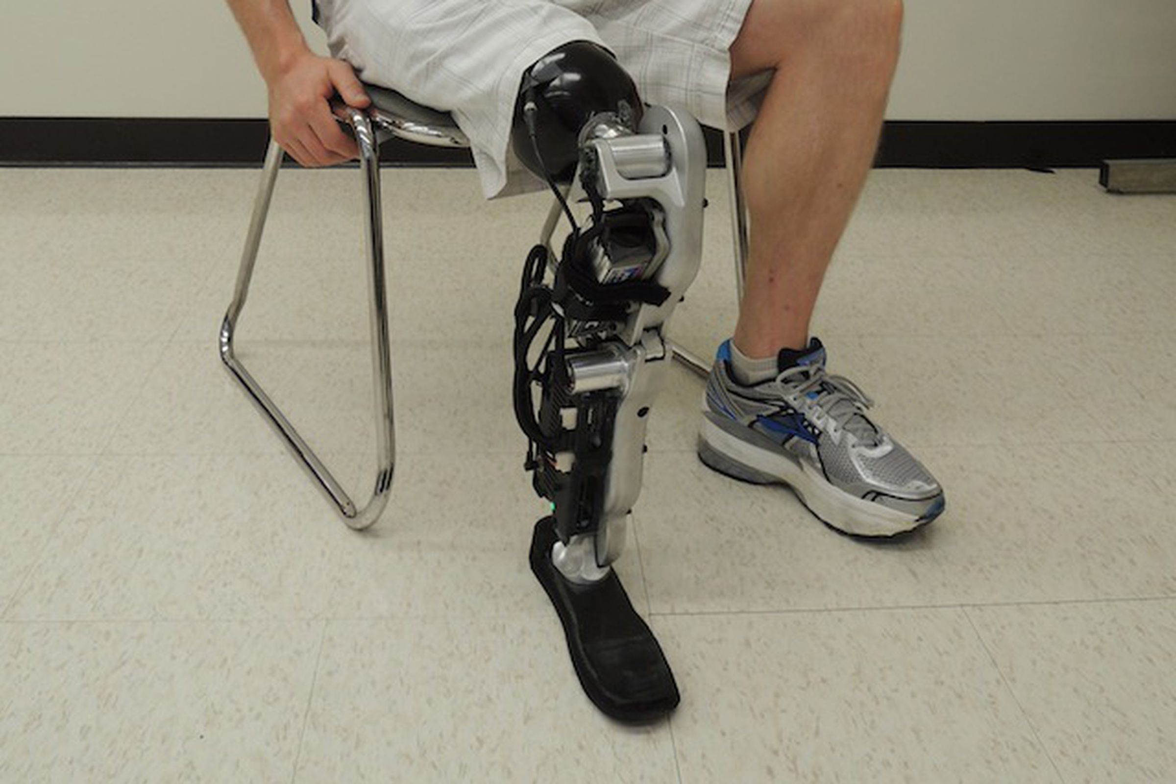 ric bionic leg
