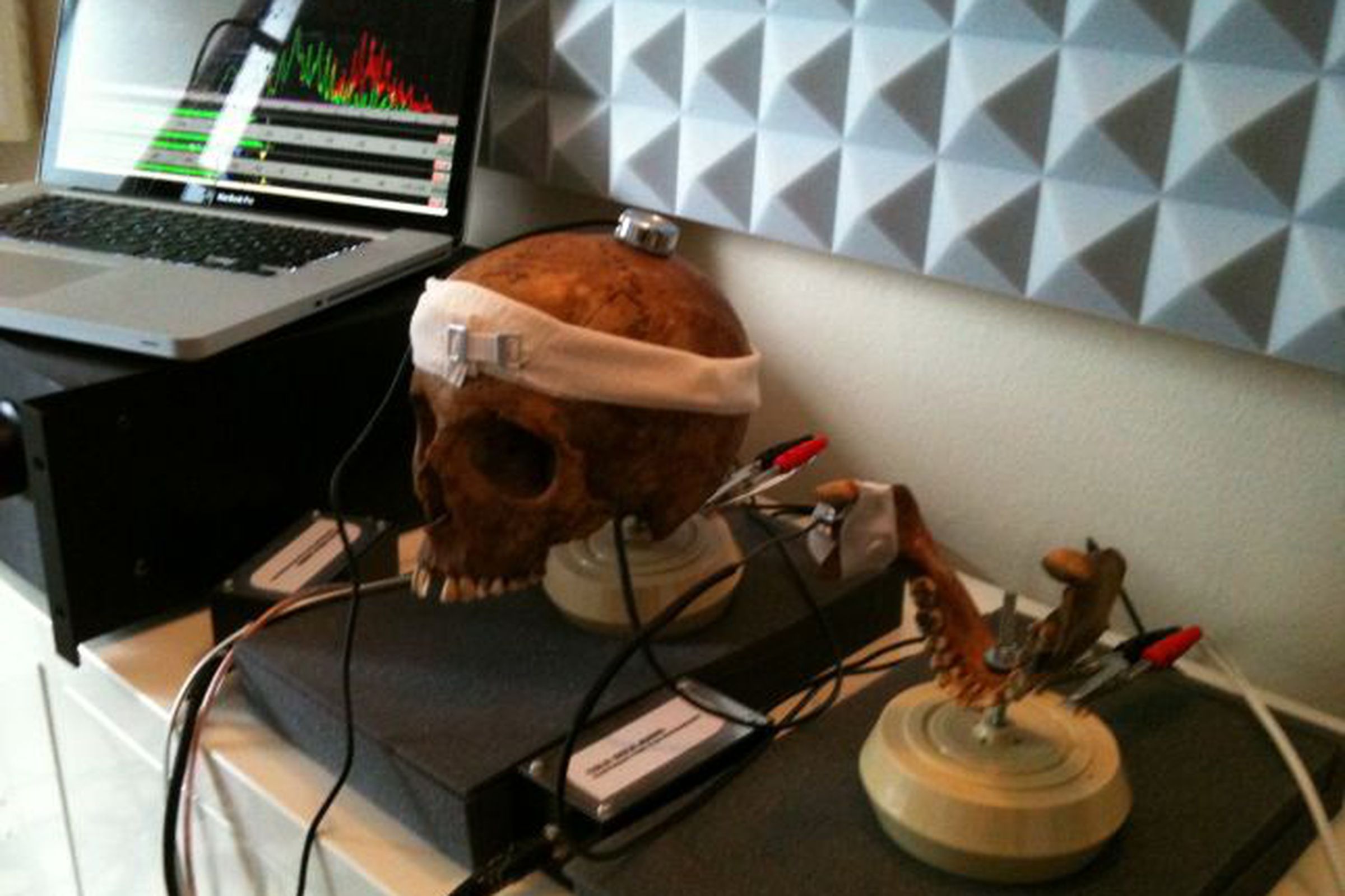 Inside skull recording