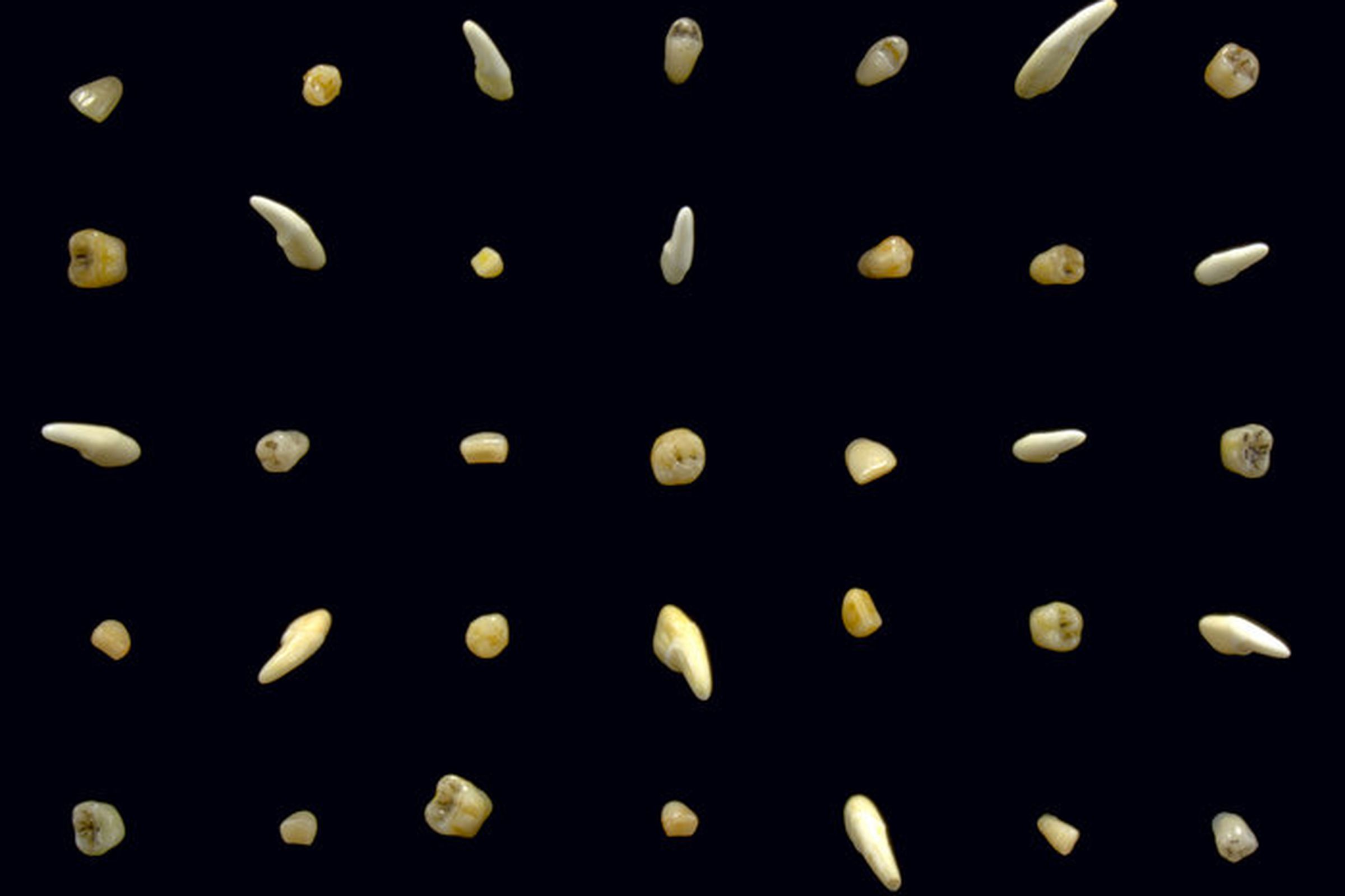 Rows of teeth against a black background