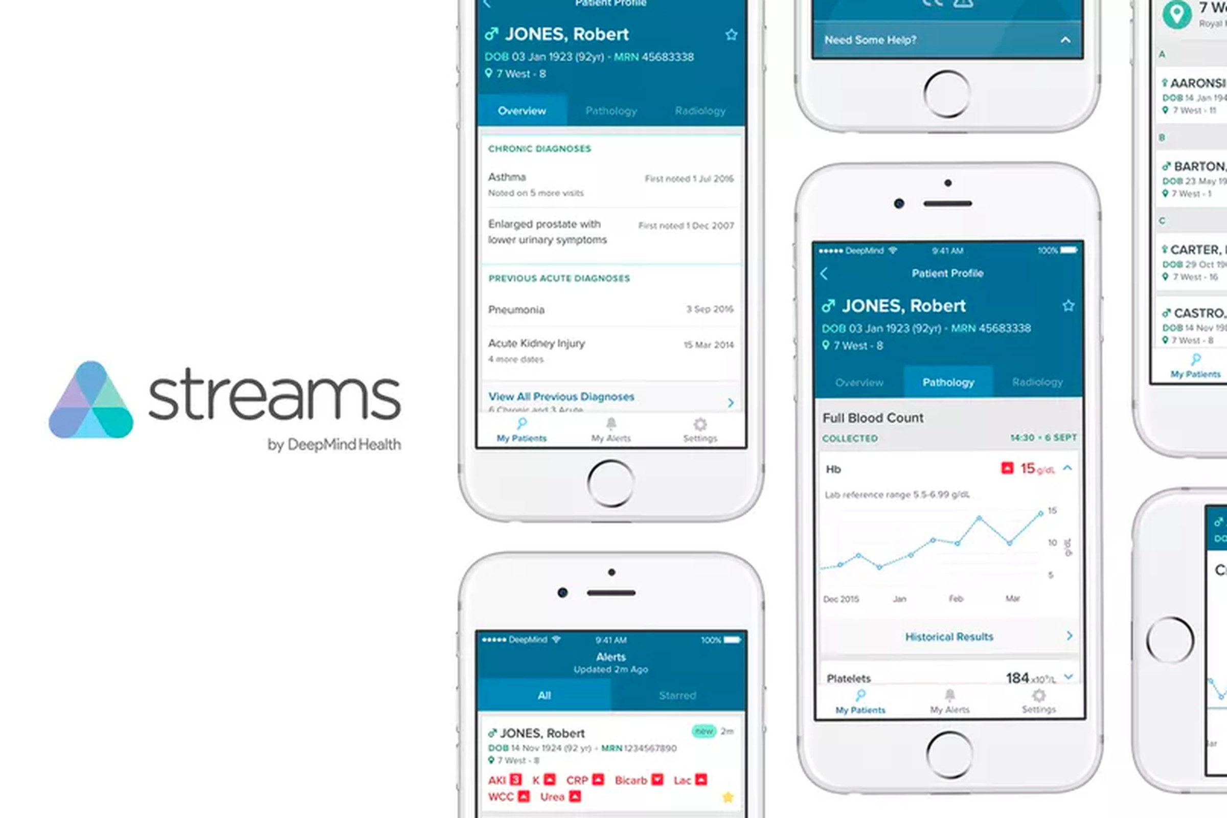DeepMind Health’s most prominent product is its Streams app, which helps manage patients in hospitals. 