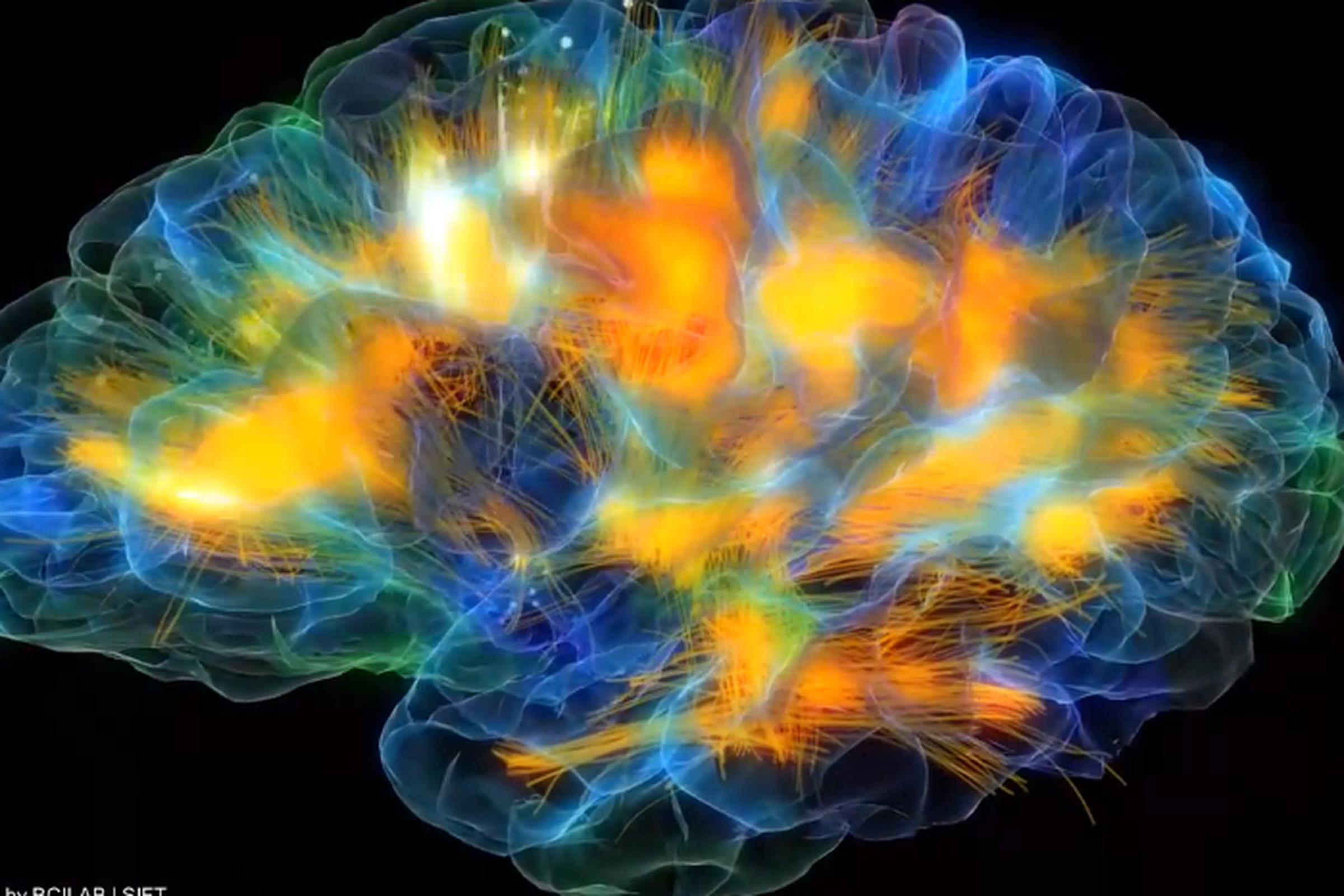 Only brains. Нейронная сеть мозга. Нейронные сети головного мозга. Радужный мозг. Нейронные связи в мозге.