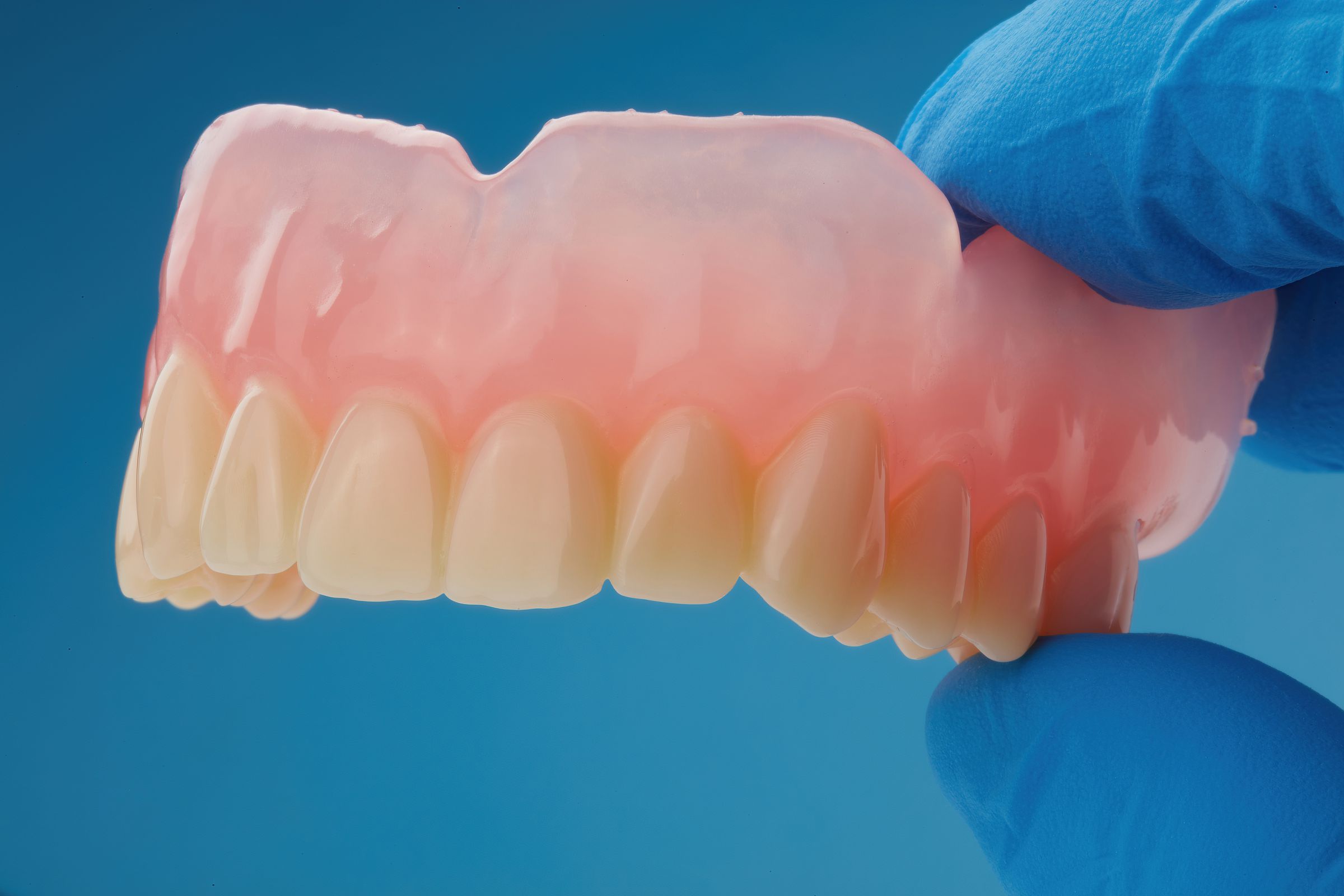 Dentures made with Formlabs’ premium resin.