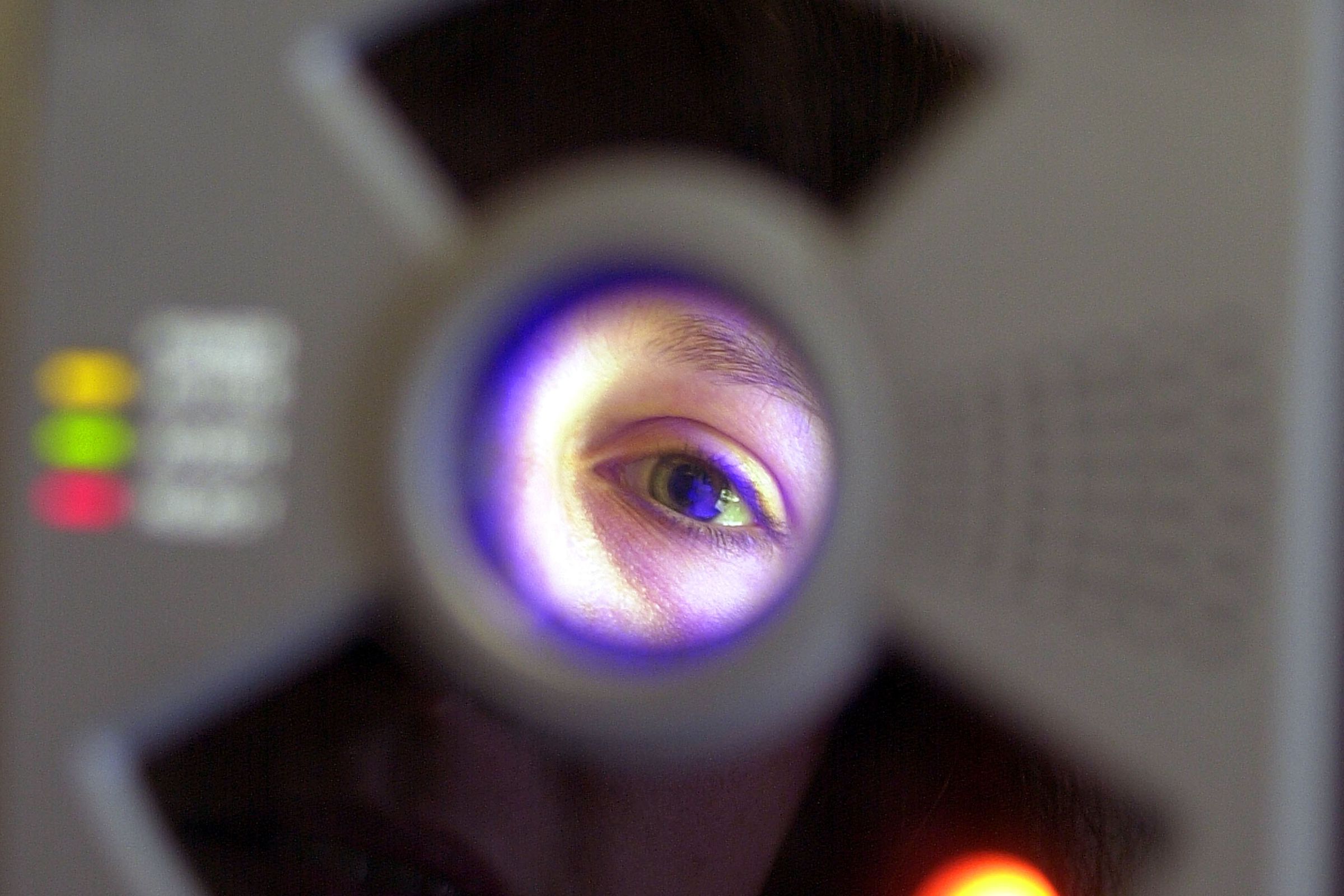 An image of an eye ringed by medical equipment. 